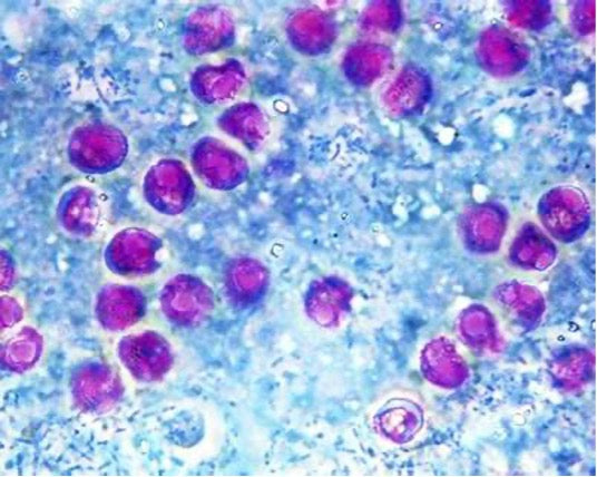 What Are Cysts in Water? Why They Matter — and How Natural Action Helps Protect Your Home